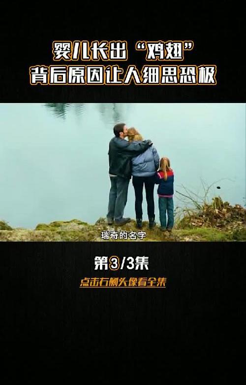 瑞奇